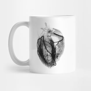 Coronary arteriogram of arteries of the heart 1904 (P216/0201) Mug